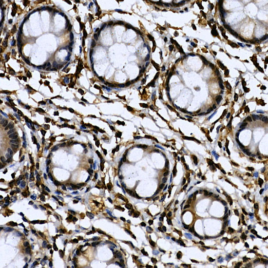 Immunohistochemistry of paraffin-embedded human colon using CDK19 Polyclonal Antibody at dilution of 1:100 (40x lens).Perform high pressure antigen retrieval with 10 mM citrate buffer pH 6.0 before commencing with IHC staining protocol.