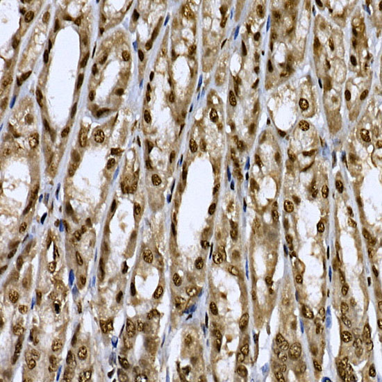 Immunohistochemistry of paraffin-embedded mouse stomach using CDK19 Polyclonal Antibody at dilution of 1:100 (40x lens).Perform high pressure antigen retrieval with 10 mM citrate buffer pH 6.0 before commencing with IHC staining protocol.