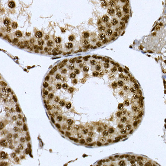 Immunohistochemistry of paraffin-embedded mouse testis using CDK19 Polyclonal Antibody at dilution of 1:100 (40x lens).Perform high pressure antigen retrieval with 10 mM citrate buffer pH 6.0 before commencing with IHC staining protocol.