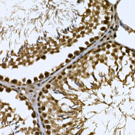 Immunohistochemistry of paraffin-embedded rat testis using CDK19 Polyclonal Antibody at dilution of 1:100 (40x lens).Perform high pressure antigen retrieval with 10 mM citrate buffer pH 6.0 before commencing with IHC staining protocol.