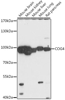 Western blot analysis of extracts of various cell lines using COG4 Polyclonal Antibody at 1:1000 dilution.