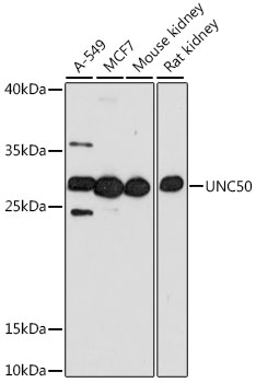 Western blot analysis of extracts of various cell lines using UNC50 Polyclonal Antibody at 1:1000 dilution.