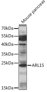 Western blot analysis of extracts of mouse pancreas using ARL15 Polyclonal Antibody at 1:1000 dilution.