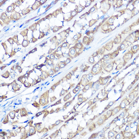 Immunohistochemistry of paraffin-embedded rat stomach using TRPV6 Polyclonal Antibody at dilution of 1:100 (40x lens).Perform high pressure antigen retrieval with 10 mM citrate buffer pH 6.0 before commencing with IHC staining protocol.