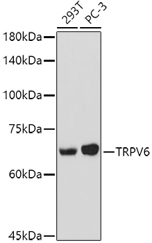 Western blot analysis of extracts of various cell lines using TRPV6 Polyclonal Antibody at 1:1000 dilution.