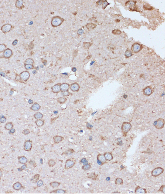 Immunohistochemistry of paraffin-embedded Rat brain using OR2S2 Polyclonal Antibody at dilution of 1:100 (40x lens).Perform microwave antigen retrieval with 10 mM PBS buffer pH 7.2 before commencing with IHC staining protocol.