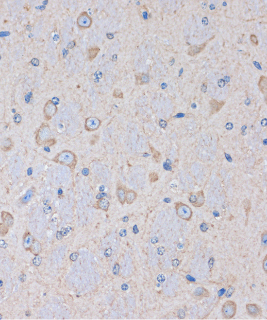 Immunohistochemistry of paraffin-embedded Mouse brain using OR2S2 Polyclonal Antibody at dilution of 1:100 (40x lens).Perform microwave antigen retrieval with 10 mM PBS buffer pH 7.2 before commencing with IHC staining protocol.