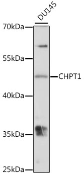 Western blot analysis of extracts of DU145 cells using CHPT1 Polyclonal Antibody at 1:1000 dilution.