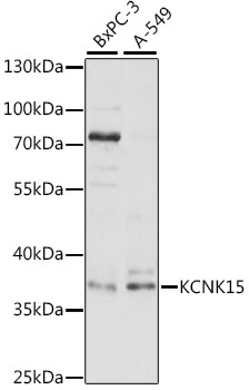 Western blot analysis of extracts of various cell lines using KCNK15 Polyclonal Antibody at 1:1000 dilution.