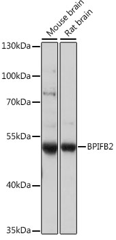 Western blot analysis of extracts of various cell lines using BPIFB2 Polyclonal Antibody at 1:1000 dilution.