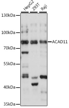 Western blot analysis of extracts of various cell lines using ACAD11 Polyclonal Antibody at 1:1000 dilution.