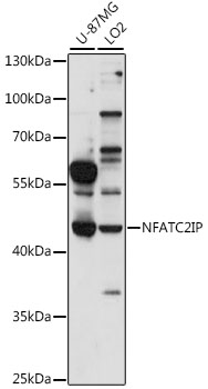 Western blot analysis of extracts of various cell lines using NFATC2IP Polyclonal Antibody at 1:1000 dilution.