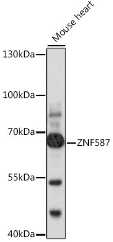 Western blot analysis of extracts of mouse heart using ZNF587 Polyclonal Antibody at 1:1000 dilution.