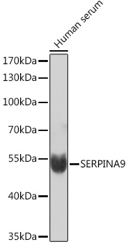 Western blot analysis of extracts of Human serum using SERPINA9 Polyclonal Antibody at1:1000 dilution.