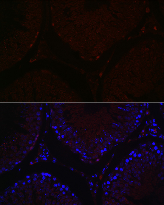 Immunofluorescence analysis of rat testis cells using Sall4 Polyclonal Antibody at dilution of 1:100 (40x lens). Blue: DAPI for nuclear staining.