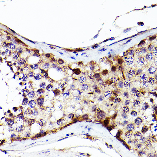 Immunohistochemistry of paraffin-embedded Human testis using Sall4 Polyclonal Antibody at dilution of 1:200 (40x lens).Perform high pressure antigen retrieval with 10 mM citrate buffer pH 6.0 before commencing with IHC staining protocol.