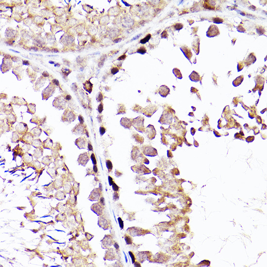 Immunohistochemistry of paraffin-embedded Rat testis using Sall4 Polyclonal Antibody at dilution of 1:200 (40x lens).Perform high pressure antigen retrieval with 10 mM citrate buffer pH 6.0 before commencing with IHC staining protocol.