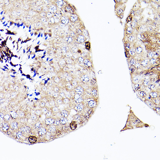 Immunohistochemistry of paraffin-embedded Mouse testis using Sall4 Polyclonal Antibody at dilution of 1:200 (40x lens).Perform high pressure antigen retrieval with 10 mM citrate buffer pH 6.0 before commencing with IHC staining protocol.