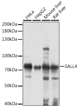 Western blot analysis of extracts of various cell lines using Sall4 Polyclonal Antibody at 1:1000 dilution.
