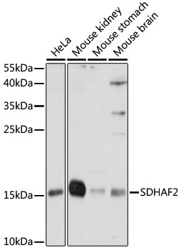 Western blot analysis of extracts of various cell lines using SDHAF2 Polyclonal Antibody at 1:1000 dilution.