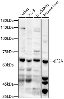 Western blot analysis of extracts of various cell lines using eIF2A Polyclonal Antibody at 1:1000 dilution.