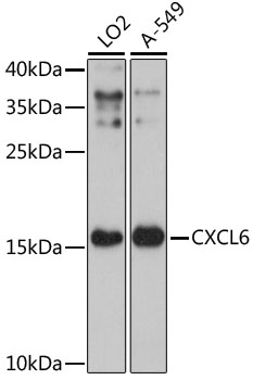 Western blot analysis of extracts of various cell lines using CXCL6 Polyclonal Antibody at 1:3000 dilution.