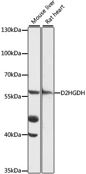 Western blot analysis of extracts of various cell lines using D2HGDH Polyclonal Antibody at 1:1000 dilution.