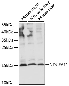 Western blot analysis of extracts of various cell lines using NDUFA11 Polyclonal Antibody at 1:1000 dilution.