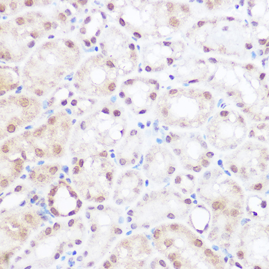 Immunohistochemistry of paraffin-embedded mouse kidney using BRD2 Polyclonal Antibody at dilution of 1:50 (40x lens).Perform high pressure antigen retrieval with 10 mM citrate buffer pH 6.0 before commencing with IHC staining protocol.