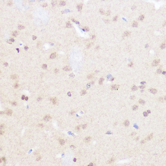 Immunohistochemistry of paraffin-embedded rat brain using BRD2 Polyclonal Antibody at dilution of 1:50 (40x lens).Perform high pressure antigen retrieval with 10 mM citrate buffer pH 6.0 before commencing with IHC staining protocol.