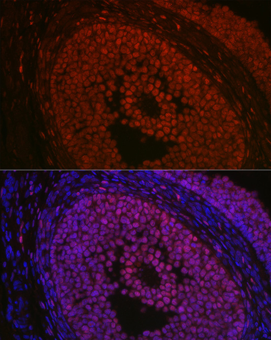 Immunofluorescence analysis of rat ovary using FOXL2 Polyclonal Antibody at dilution of 1:100 (40x lens). Blue: DAPI for nuclear staining.