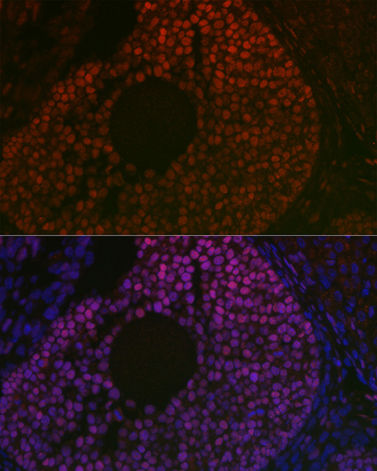 Immunofluorescence analysis of mouse ovary using FOXL2 Polyclonal Antibody at dilution of 1:100 (40x lens). Blue: DAPI for nuclear staining.