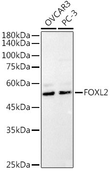 Western blot analysis of extracts of various cell lines using Polyclonal Antibody at1:1000 dilution.