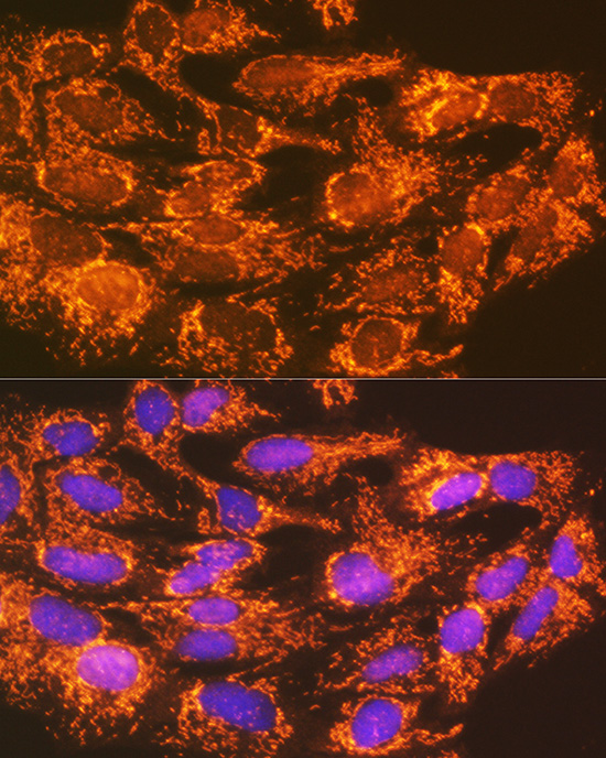 Immunofluorescence analysis of C6 cells using ACSL1 Polyclonal Antibody at dilution of 1:100 (40x lens). Blue: DAPI for nuclear staining.