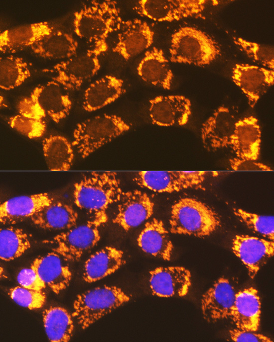 Immunofluorescence analysis of NIH-3T3 cells using ACSL1 Polyclonal Antibody at dilution of 1:100 (40x lens). Blue: DAPI for nuclear staining.