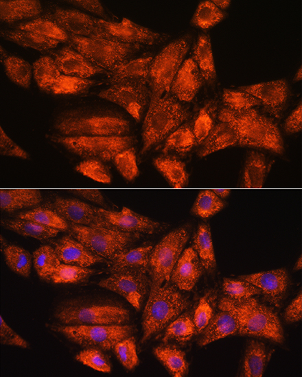 Immunofluorescence analysis of H9C2 cells using PPP1R15A Polyclonal Antibody at dilution of 1:100. Blue: DAPI for nuclear staining.