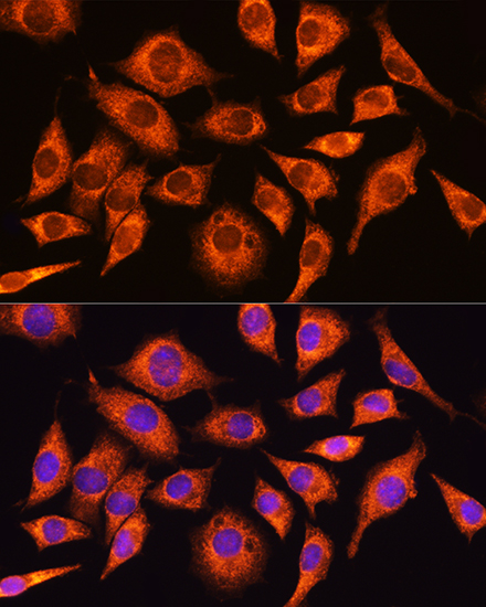 Immunofluorescence analysis of L929 cells using PPP1R15A Polyclonal Antibody at dilution of 1:100. Blue: DAPI for nuclear staining.