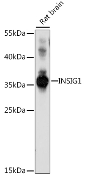 Western blot analysis of extracts of rat brain using INSIG1 Polyclonal Antibody at 1:1000 dilution.