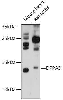 Western blot analysis of extracts of various cell lines using DPPA5 Polyclonal Antibody at 1:1000 dilution.