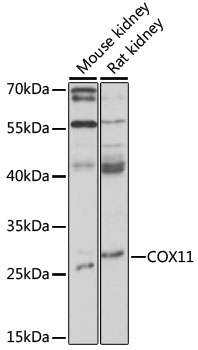 Western blot analysis of extracts of various cell lines using COX11 Polyclonal Antibody at 1:1000 dilution.