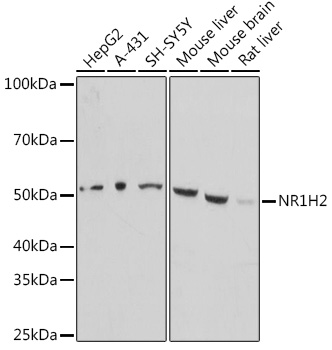 Western blot analysis of extracts of various cell lines using NR1H2 Polyclonal Antibody at 1:1000 dilution.