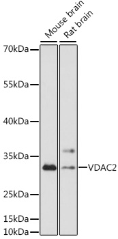 Western blot analysis of extracts of various cell lines using VDAC2 Polyclonal Antibody at 1:1000 dilution.