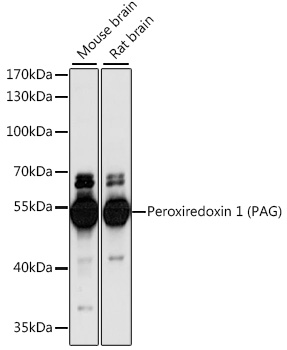 Western blot analysis of extracts of various cell lines using Peroxiredoxin 1 Polyclonal Antibody at1:1000 dilution.