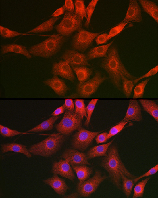 Immunofluorescence analysis of NIH/3T3 cells using Raptor Polyclonal Antibody at dilution of 1:50 (40x lens). Blue: DAPI for nuclear staining.