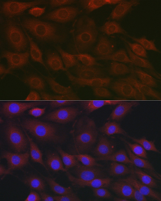 Immunofluorescence analysis of PC-12 cells using Raptor Polyclonal Antibody at dilution of 1:50 (40x lens). Blue: DAPI for nuclear staining.