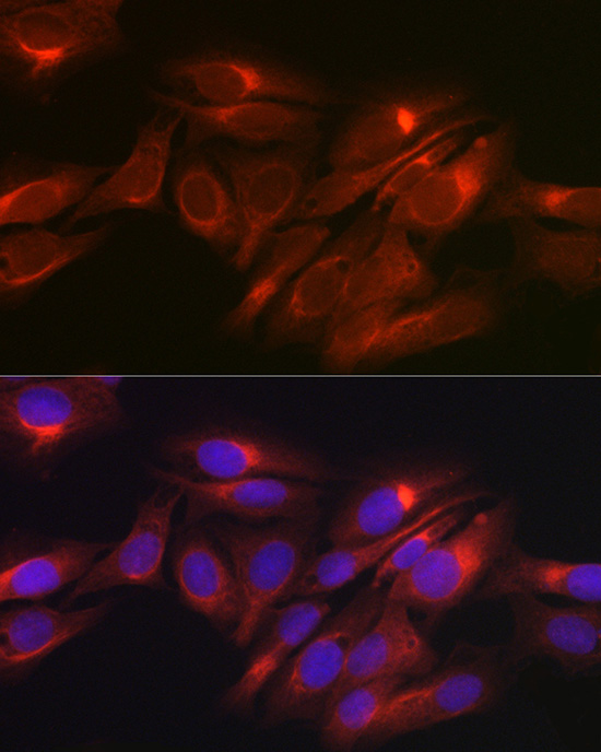 Immunofluorescence analysis of U2OS cells using Raptor Polyclonal Antibody at dilution of 1:50 (40x lens). Blue: DAPI for nuclear staining.