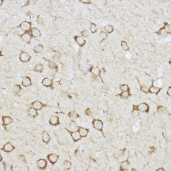 Immunohistochemistry of paraffin-embedded mouse brain using Raptor Polyclonal Antibody at dilution of 1:100 (40x lens).Perform high pressure antigen retrieval with 10 mM citrate buffer pH 6.0 before commencing with IHC staining protocol.