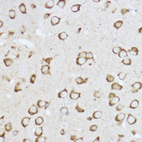 Immunohistochemistry of paraffin-embedded rat brain using Raptor Polyclonal Antibody at dilution of 1:100 (40x lens).Perform high pressure antigen retrieval with 10 mM citrate buffer pH 6.0 before commencing with IHC staining protocol.