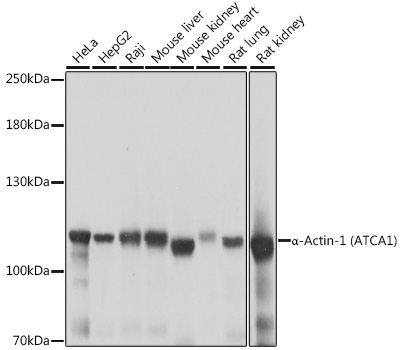 Western blot analysis of extracts of various cell lines using α-Actinin-4 Polyclonal Antibody at 1:1000 dilution.