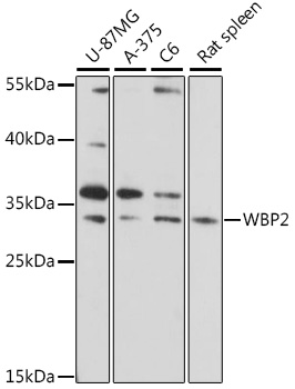 Western blot analysis of extracts of various cell lines using WBP2 Polyclonal Antibody at 1:1000 dilution.